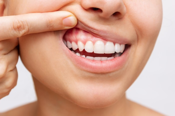 How to care for sensitive teeth and gums