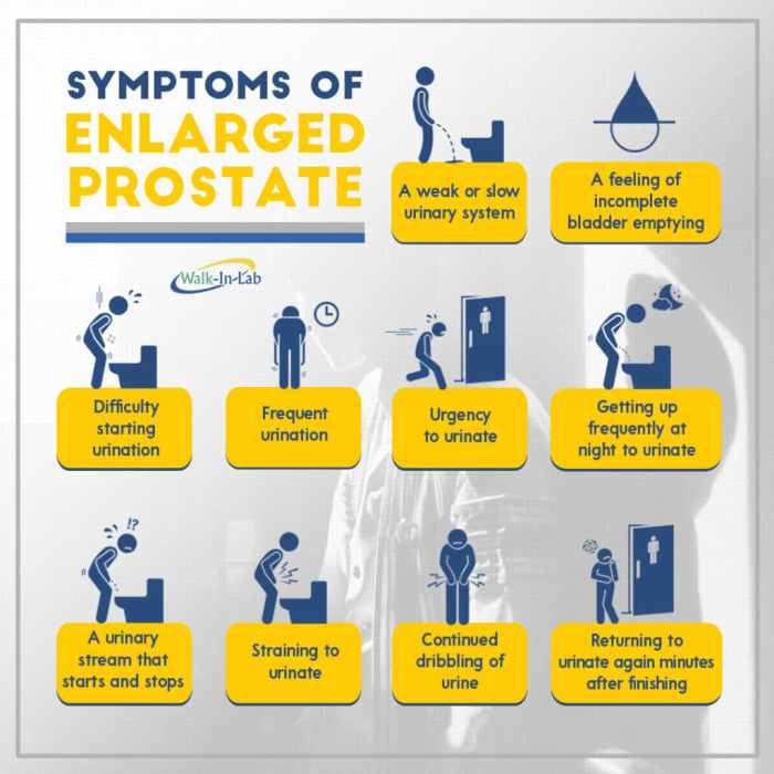 How to recognize symptoms for prostate screenings